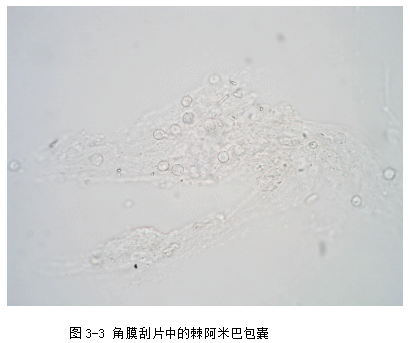 ZY016_11_4.gif